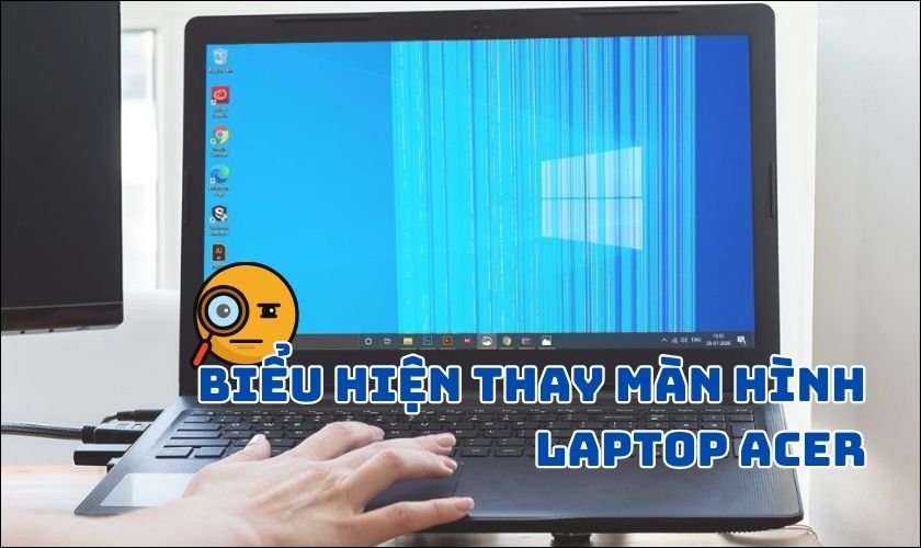 Biểu hiện cần biết trước khi thay màn hình laptop Acer